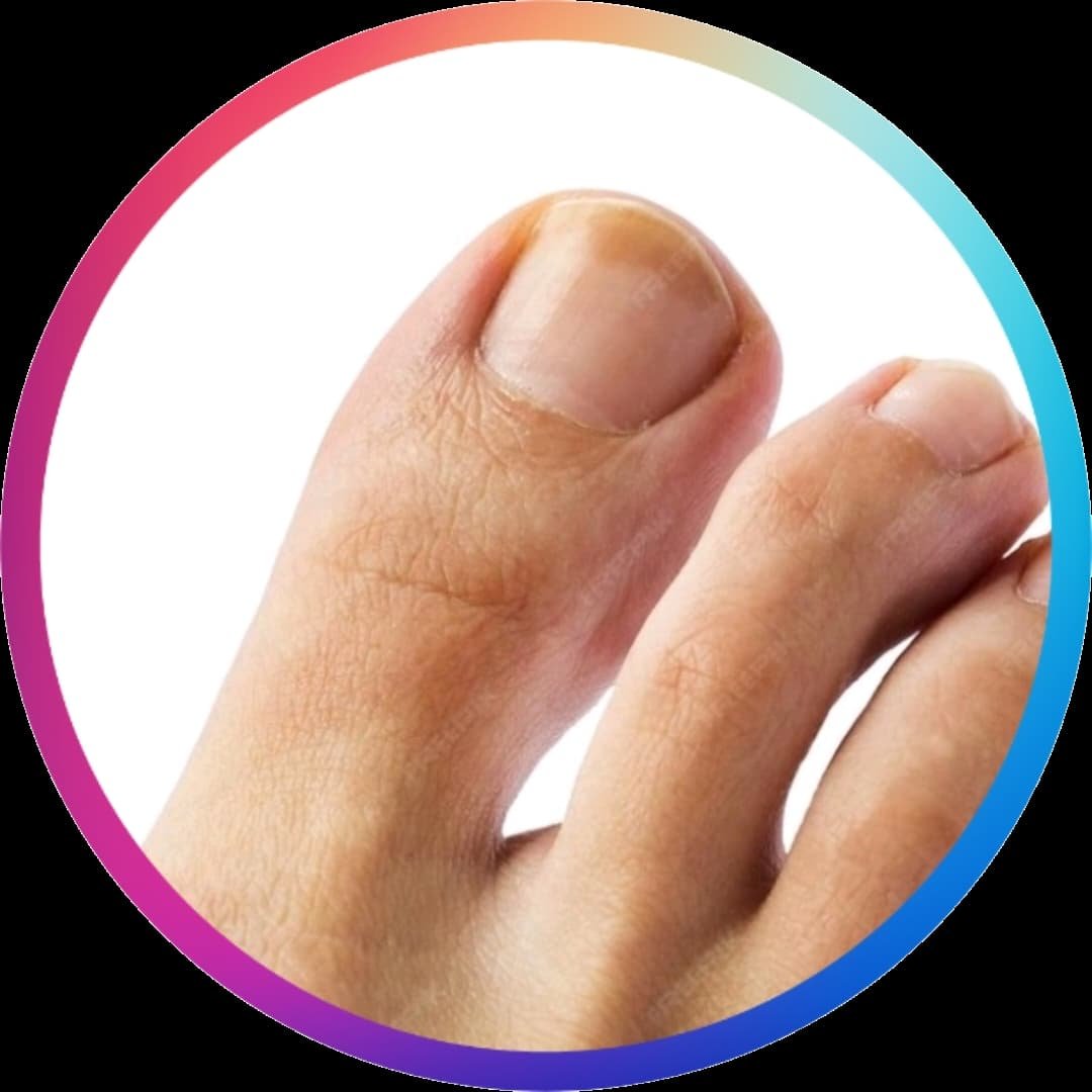 CAMBIO DE COLORACIÓN